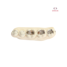 Bloque Entrenamiento Simulador de Caries 11000 Orais