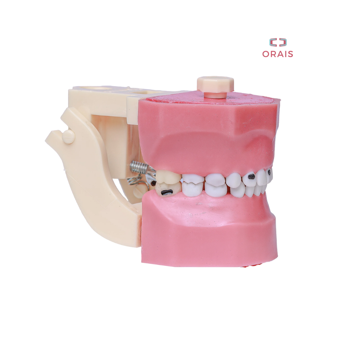 Arcada de Odontopediatria con Caries 602 Orais
